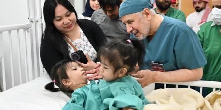 إنفاذًا لتوجيهات خادم الحرمين الشريفين وولي العهد.. بدء عملية فصل التوأم الملتصق الفلبيني (أوليفيا وجيانا)